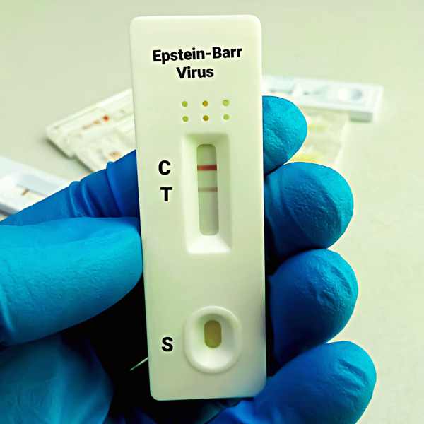 Suplementacja Transfer Factorów w okresie ciężkiej infekcji wirusem Epstein-Barr